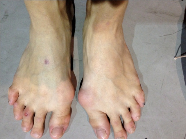 toes of ballet dancers