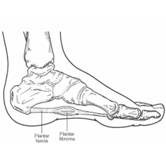 Plantar fascia - Anatomy Diagram - Lisa Howell - The Ballet Blog