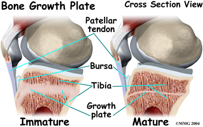 Healthy Knee Bone Growth Plate - Anatomy Diagram - Lisa Howell - The Ballet Blog